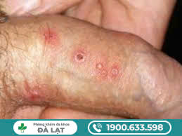 Hình ảnh minh họa